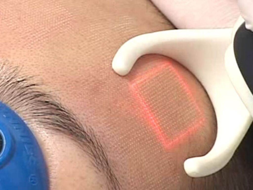 Dermatology and aesthetics 3 WhatsApp Image 2024-11-19 at 3.08.47 PM (2)