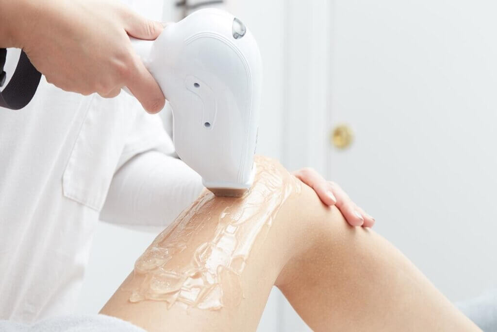 نتائج إزالة الشعر بالليزر