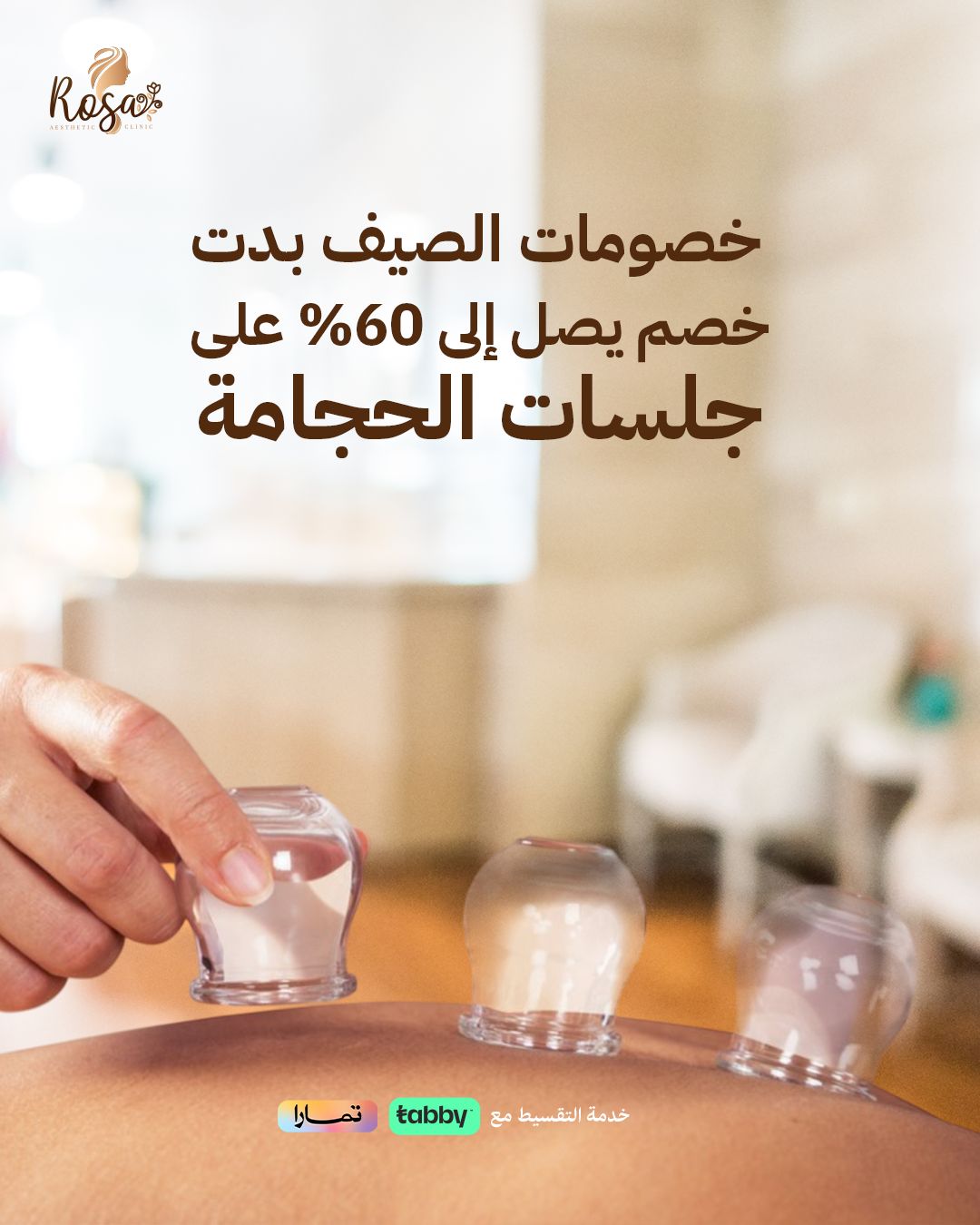 الحجامة