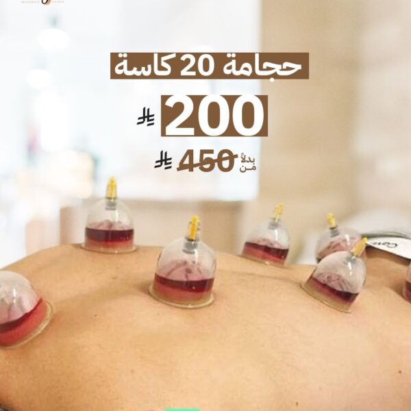 حجامة 20 كاسة