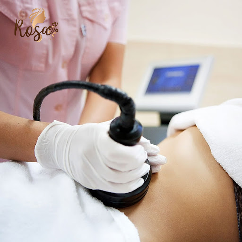 تقنية الكافيتيشن Cavitation لتفتيت الدهون وتنسيق القوام