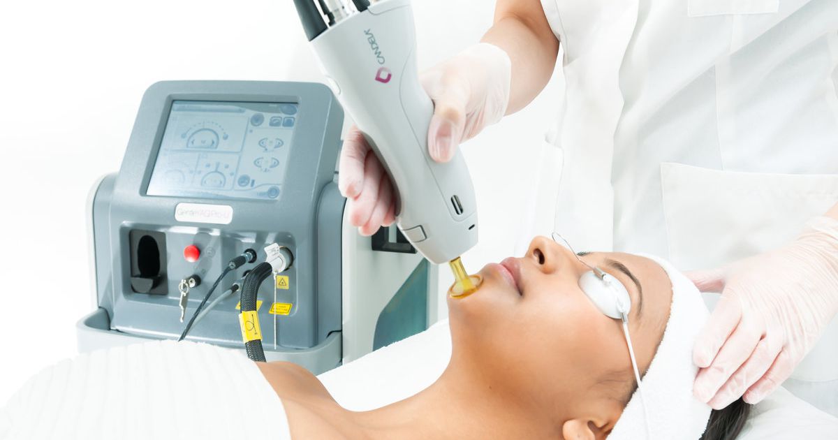 خطوات جلسة العلاج بالفراكشنال ليزر