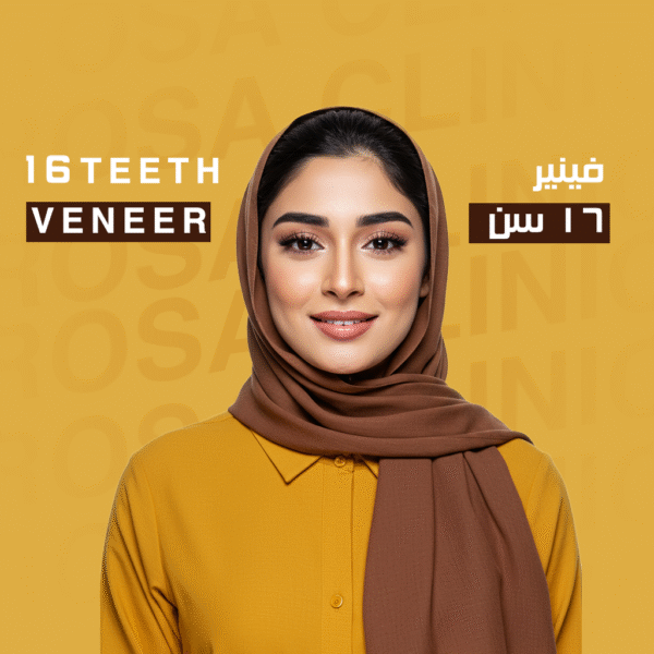 فينير 16 سن